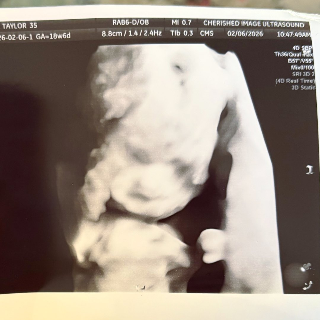 Photo shared by Taylor for their Babylist baby registry.