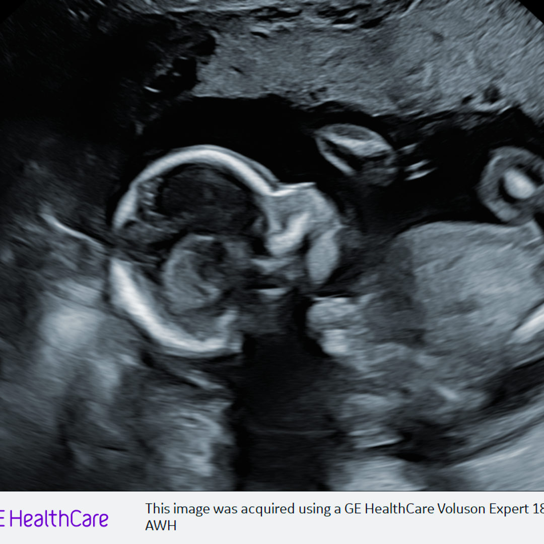 Photo shared by Annabelle for their Babylist baby registry.