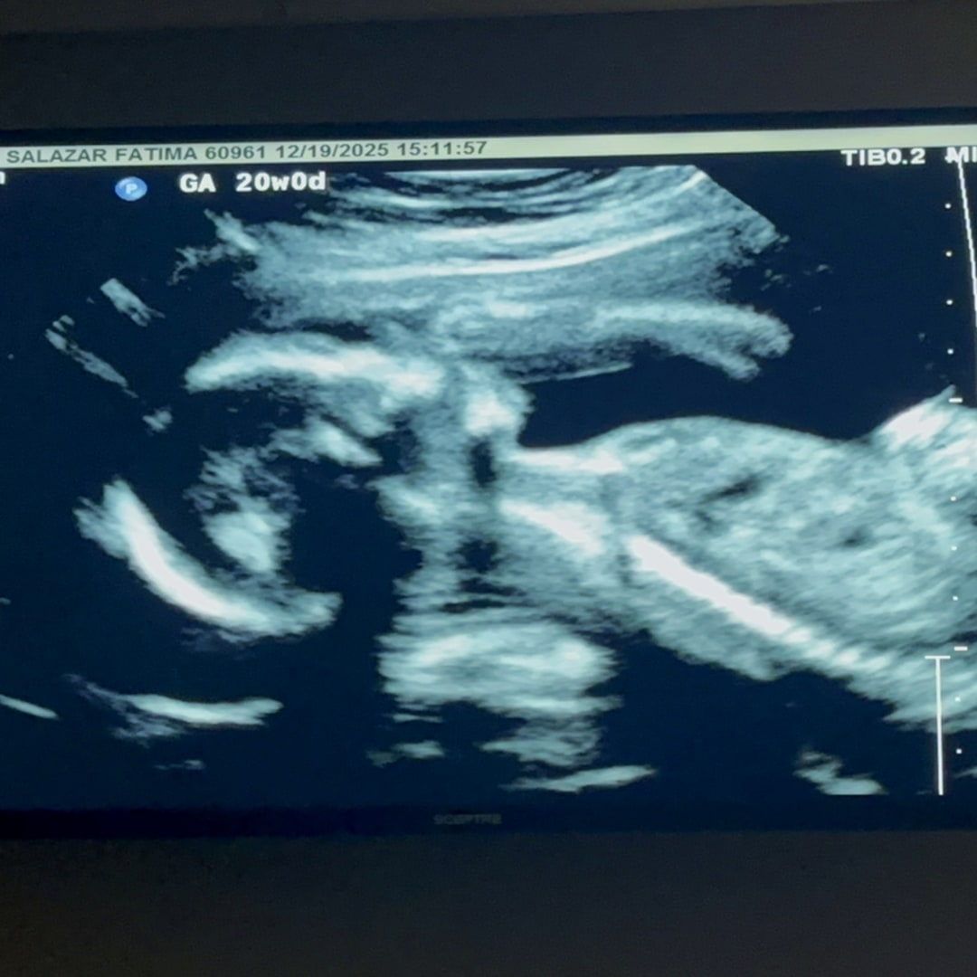 Photo shared by Fatima for their Babylist baby registry.