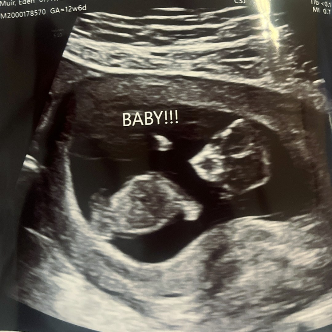 Photo shared by Eden for their Babylist baby registry.