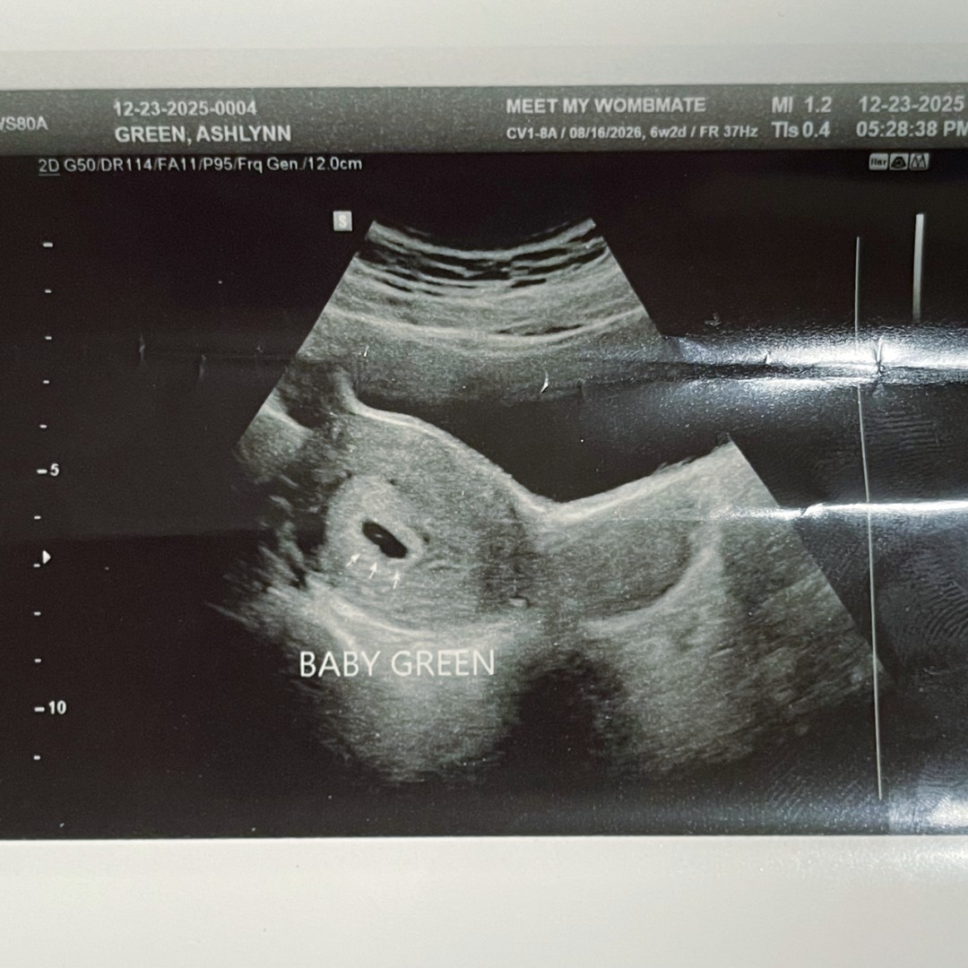 Photo shared by Ashlynn for their Babylist baby registry.