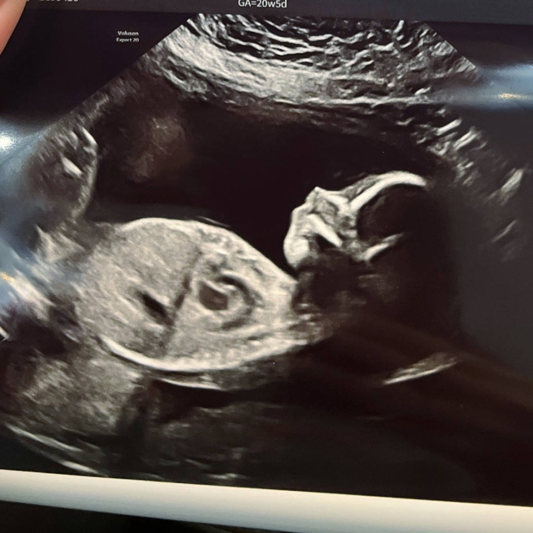 Photo shared by Vicky for their Babylist baby registry.