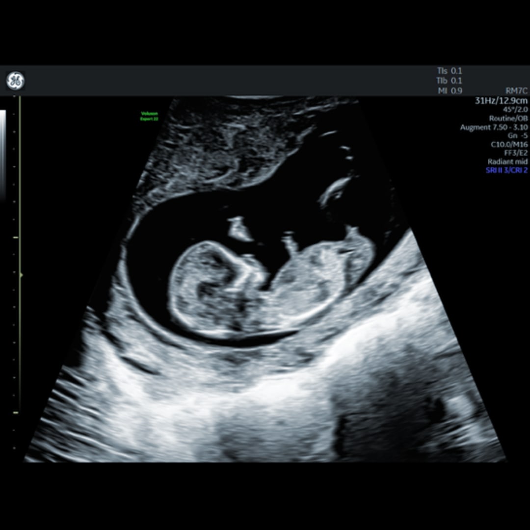 Photo shared by Josie for their Babylist baby registry.