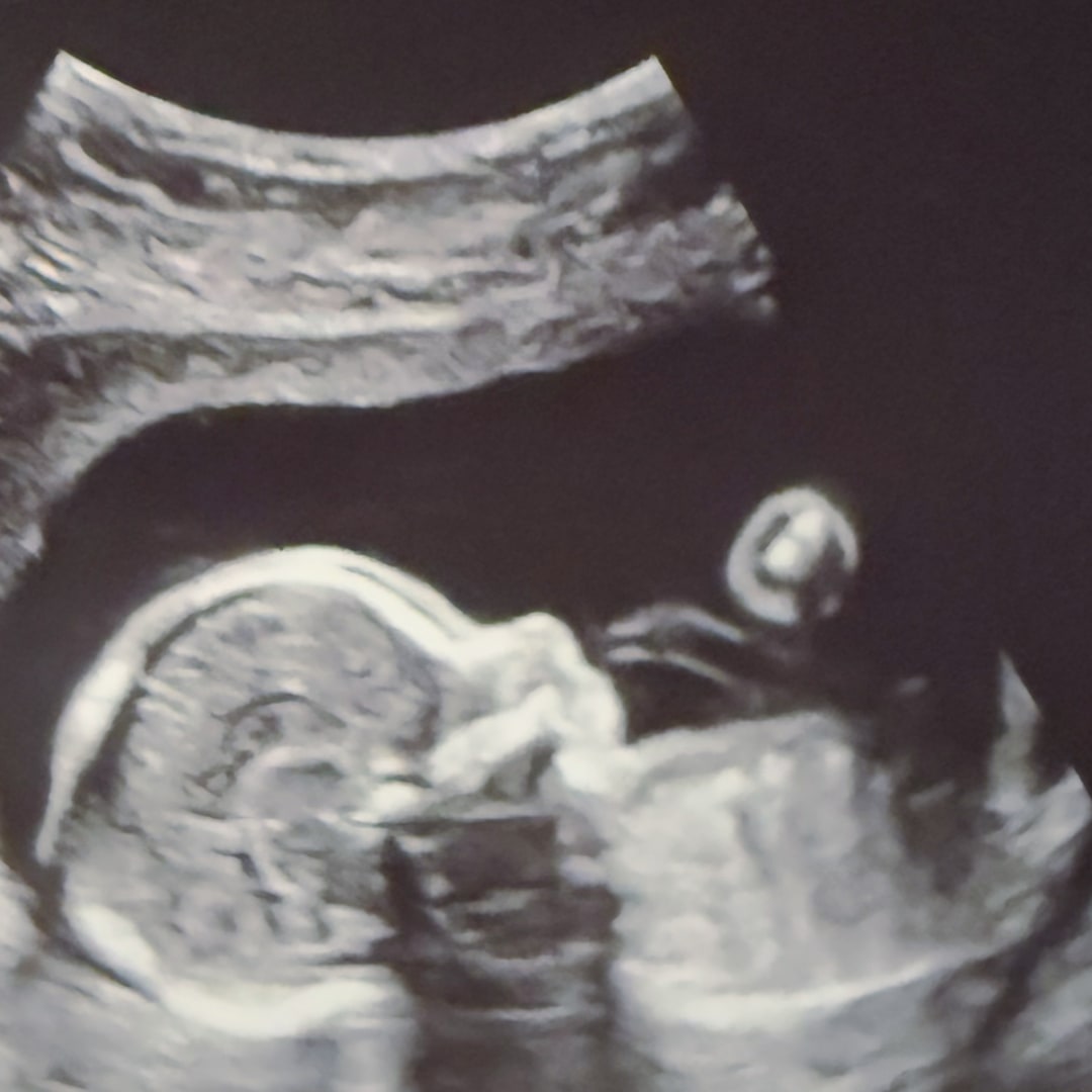 Photo shared by Ruth for their Babylist baby registry.