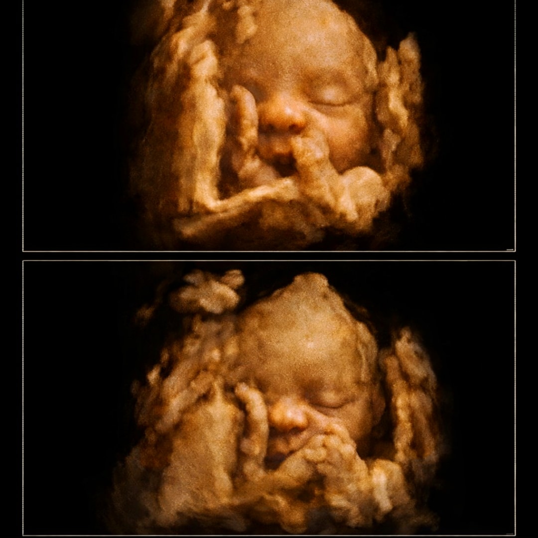 Photo shared by Tharaphi soe for their Babylist baby registry.