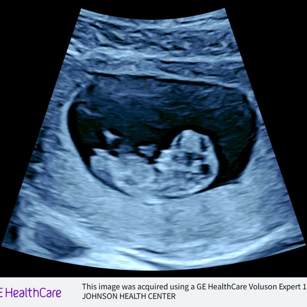 Photo shared by Ashley for their Babylist baby registry.