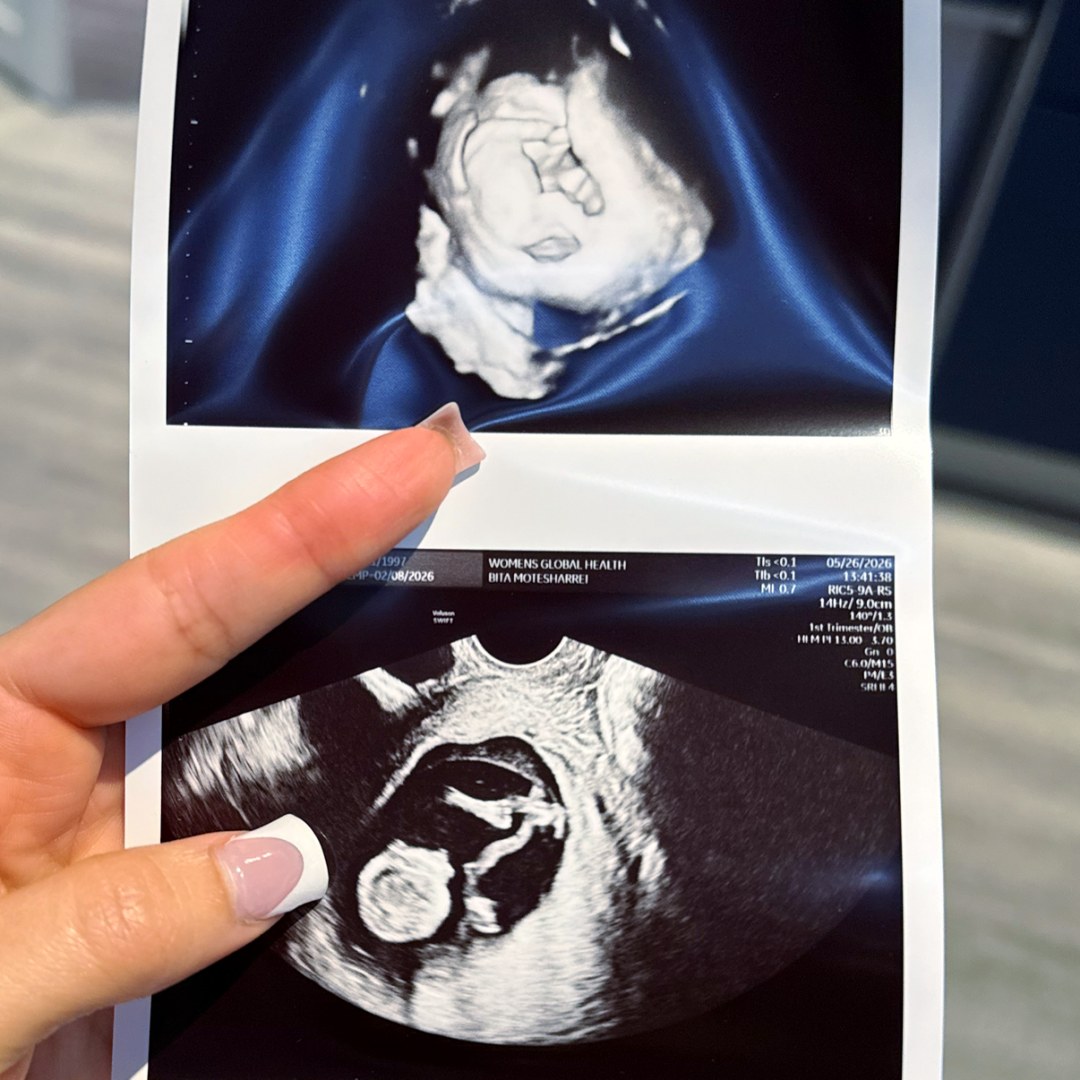 Photo shared by Arianna for their Babylist baby registry.