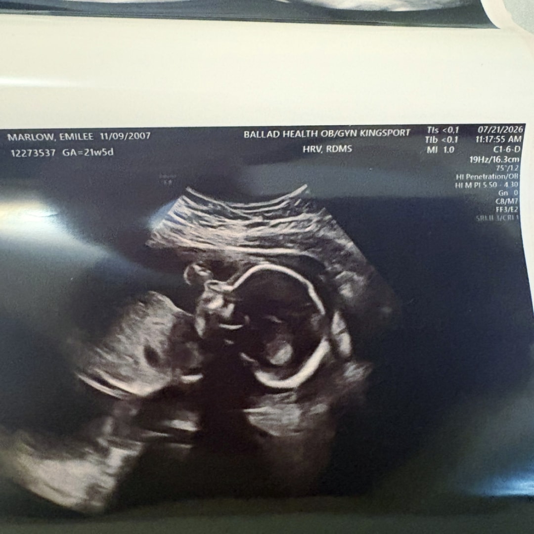 Photo shared by Emilee for their Babylist baby registry.