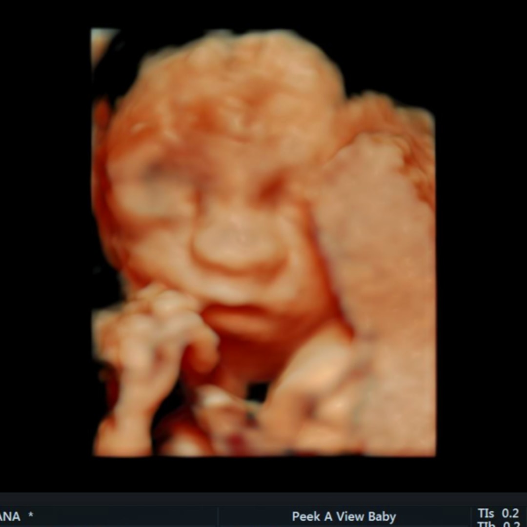 Photo shared by Jana for their Babylist baby registry.