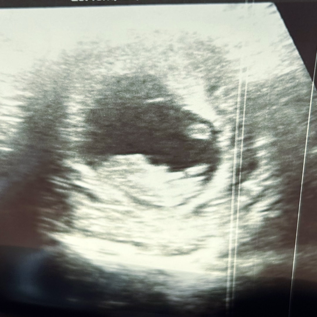 Photo shared by Taylor for their Babylist baby registry.