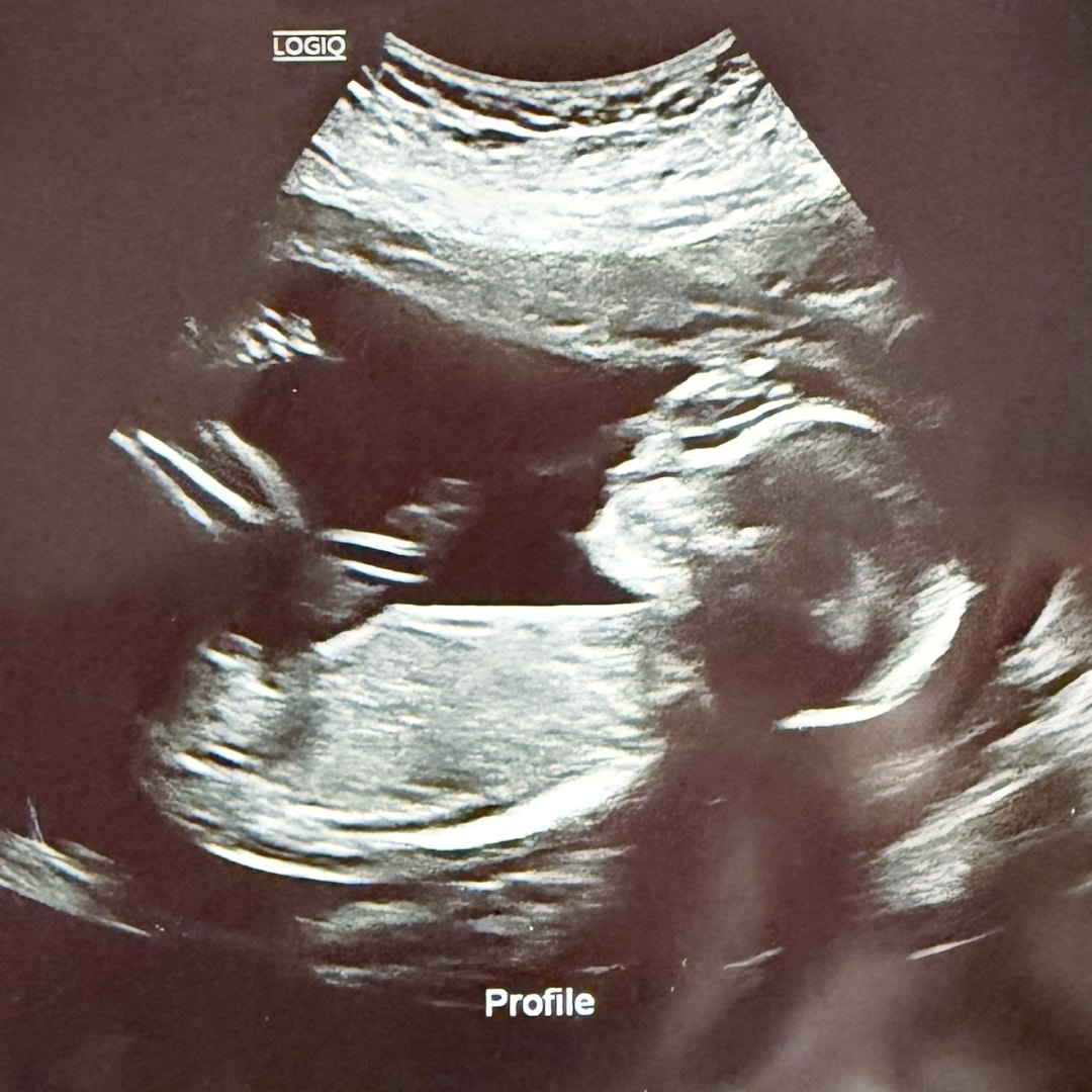 Photo shared by Ryan for their Babylist baby registry.