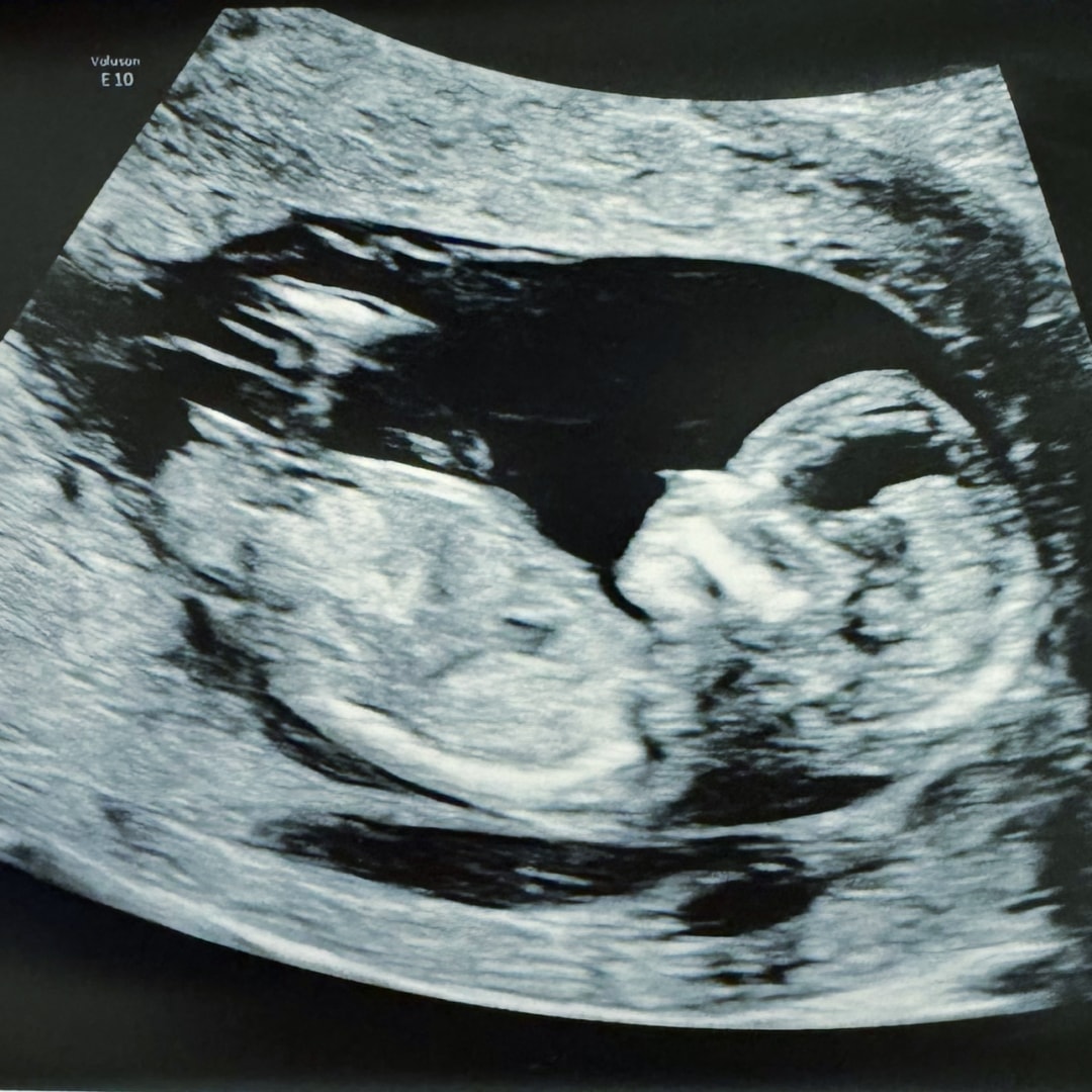 Photo shared by Sararose for their Babylist baby registry.