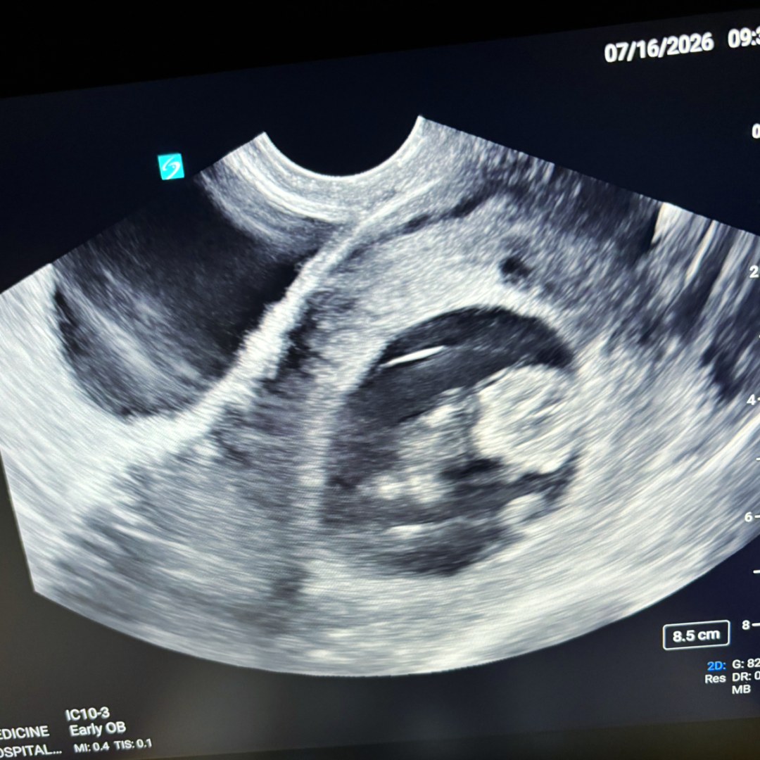 Photo shared by Deidra for their Babylist baby registry.