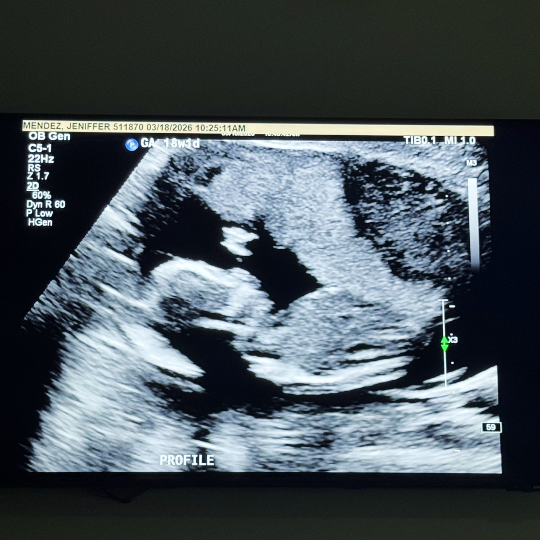 Photo shared by Jeniffer for their Babylist baby registry.