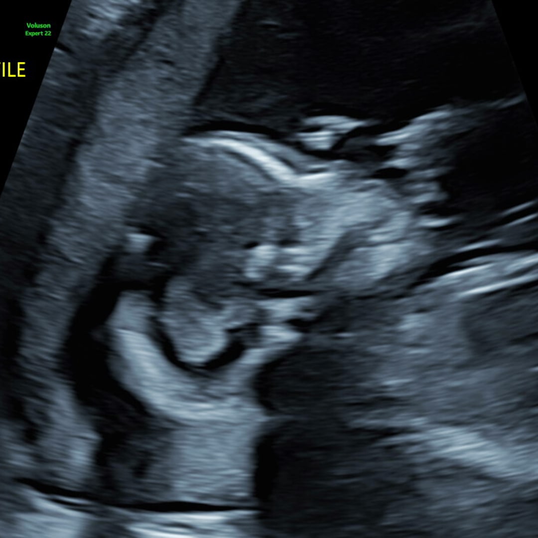 Photo shared by Lillie for their Babylist baby registry.