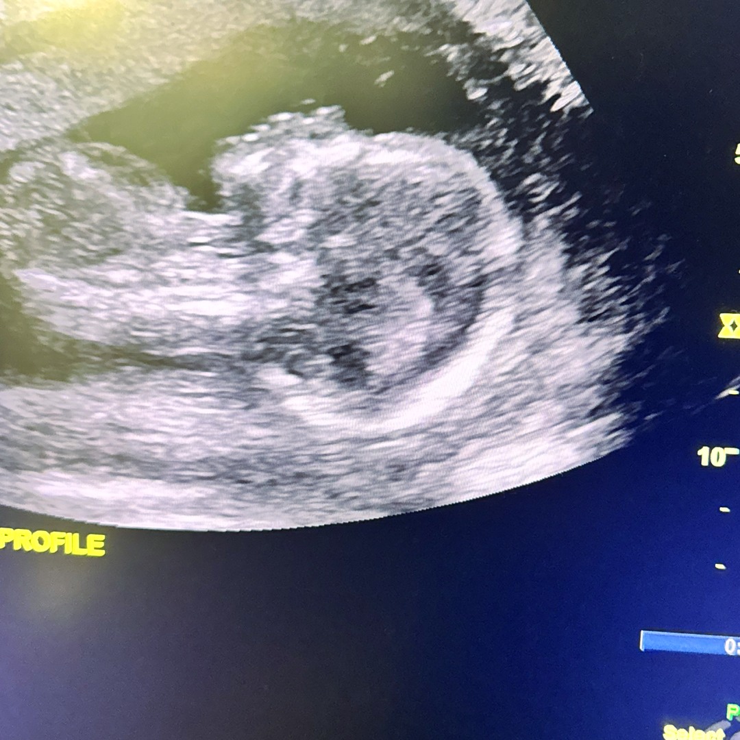 Photo shared by Jaydn for their Babylist baby registry.