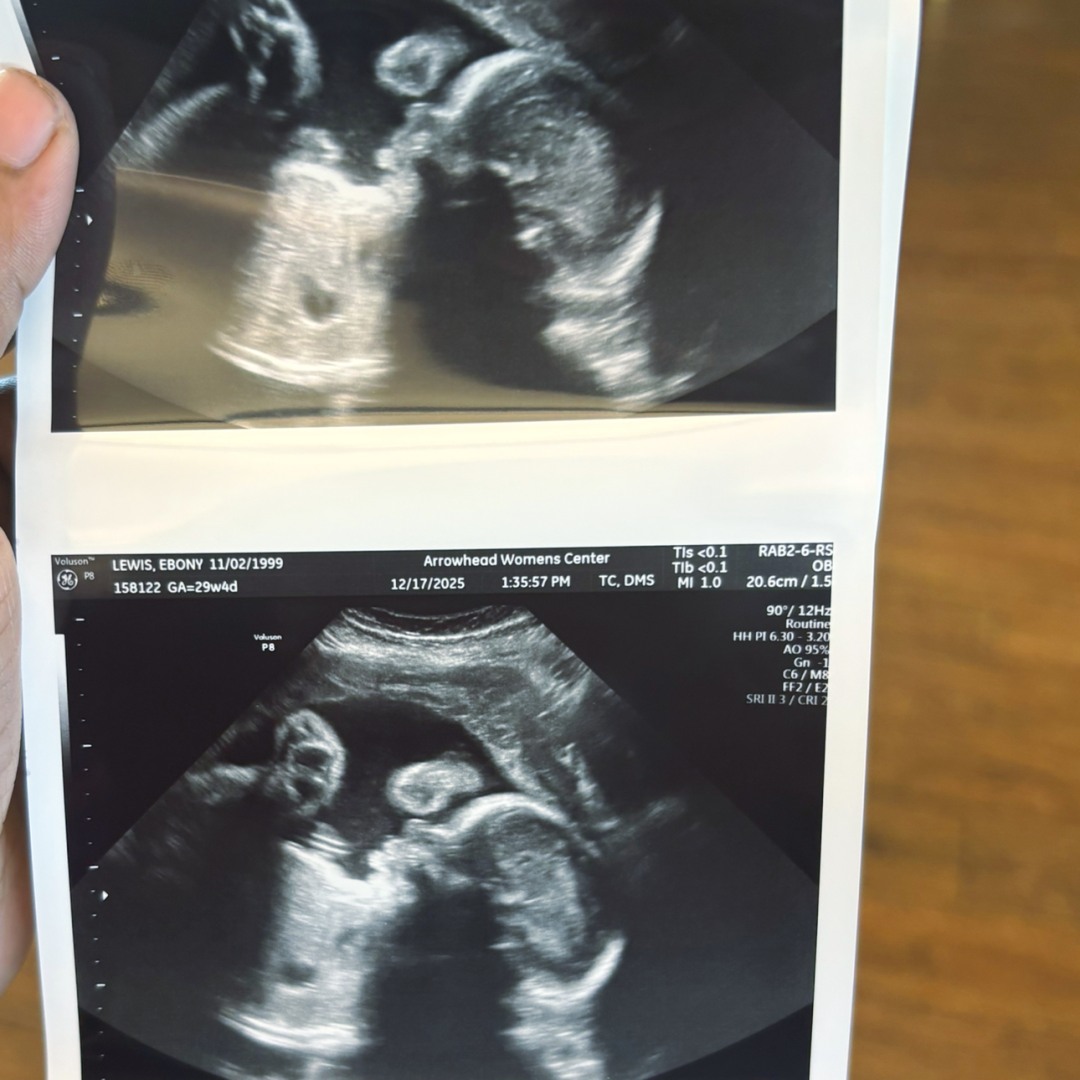 Photo shared by Ebony for their Babylist baby registry.