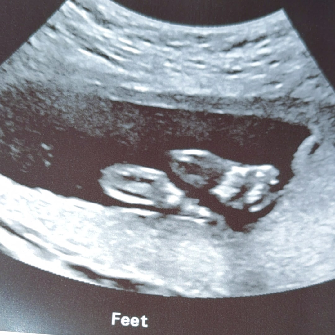 Photo shared by Zoe for their Babylist baby registry.