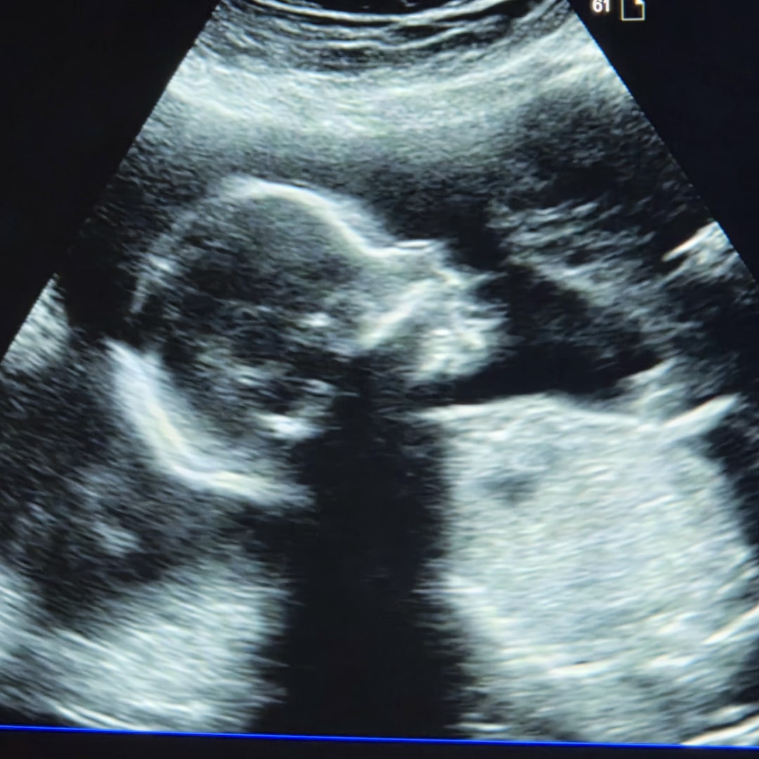 Photo shared by Kayla for their Babylist baby registry.