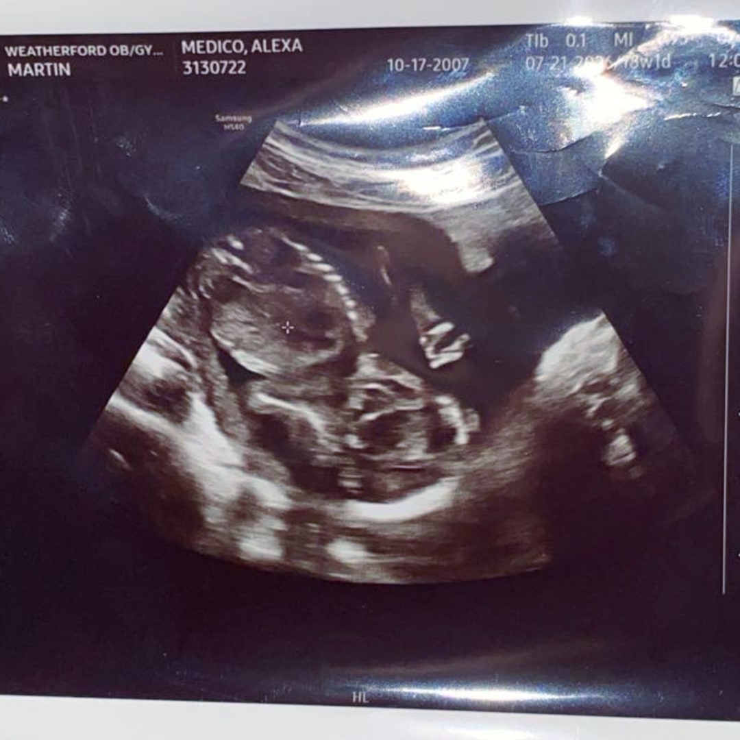 Photo shared by Alexa for their Babylist baby registry.