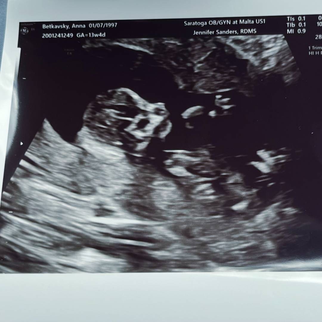 Photo shared by Anna Marie for their Babylist baby registry.