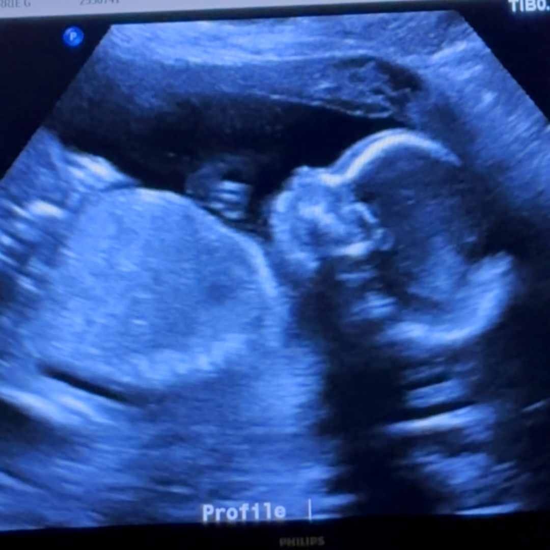 Photo shared by Corrie for their Babylist baby registry.