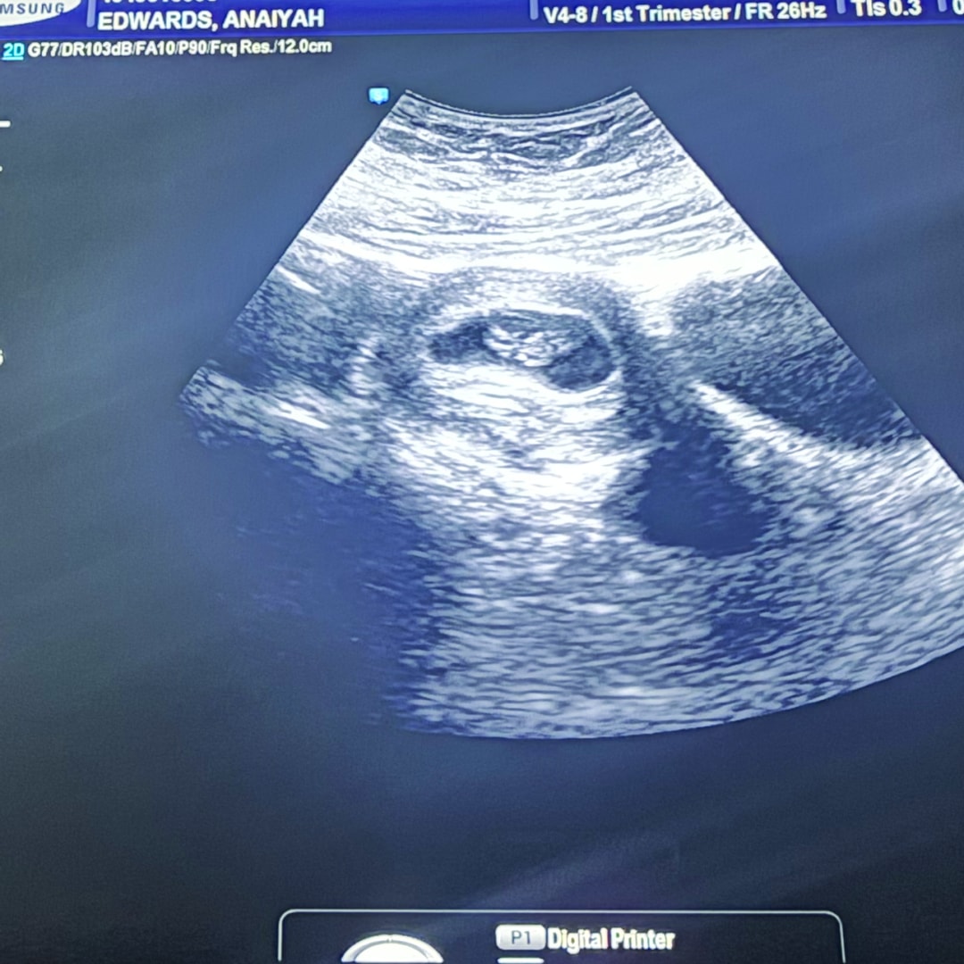 Photo shared by Anaiyah for their Babylist baby registry.