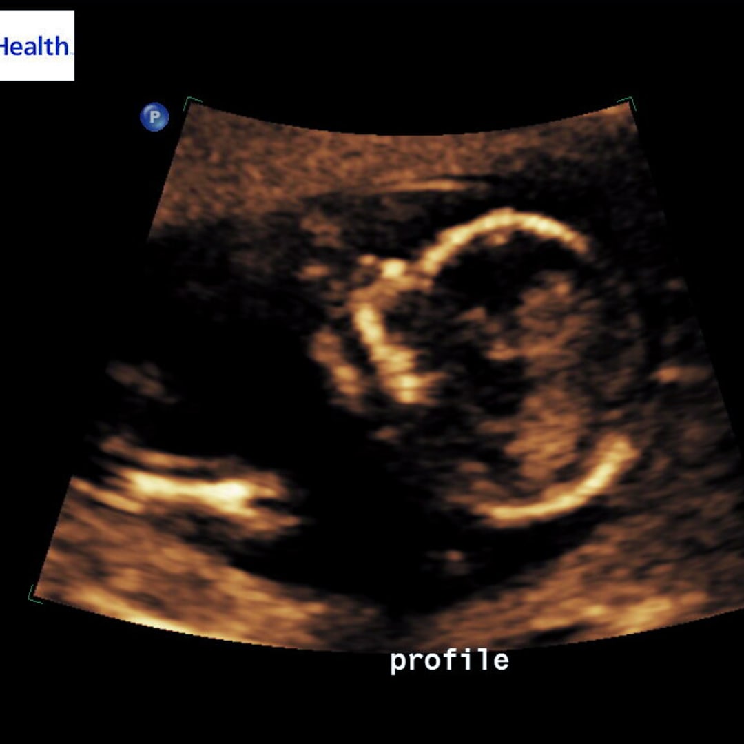 Photo shared by Brooklynn for their Babylist baby registry.