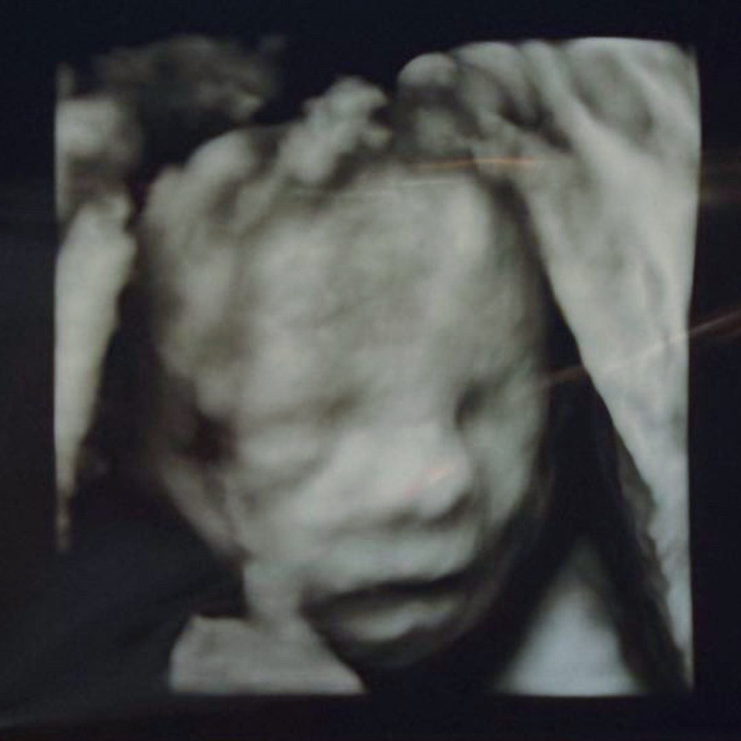 Photo shared by Erika for their Babylist baby registry.