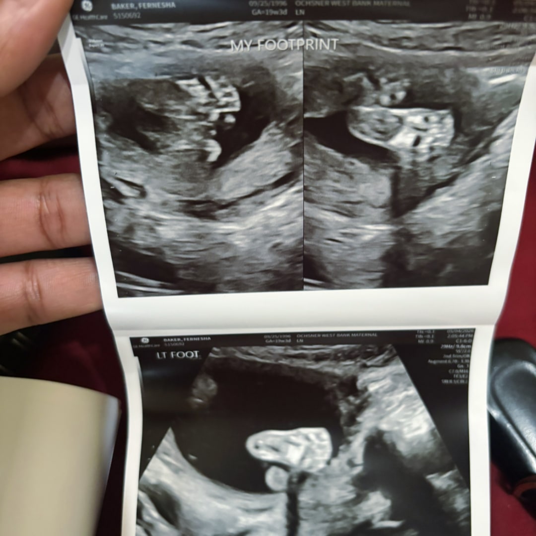 Photo shared by Fernesha for their Babylist baby registry.