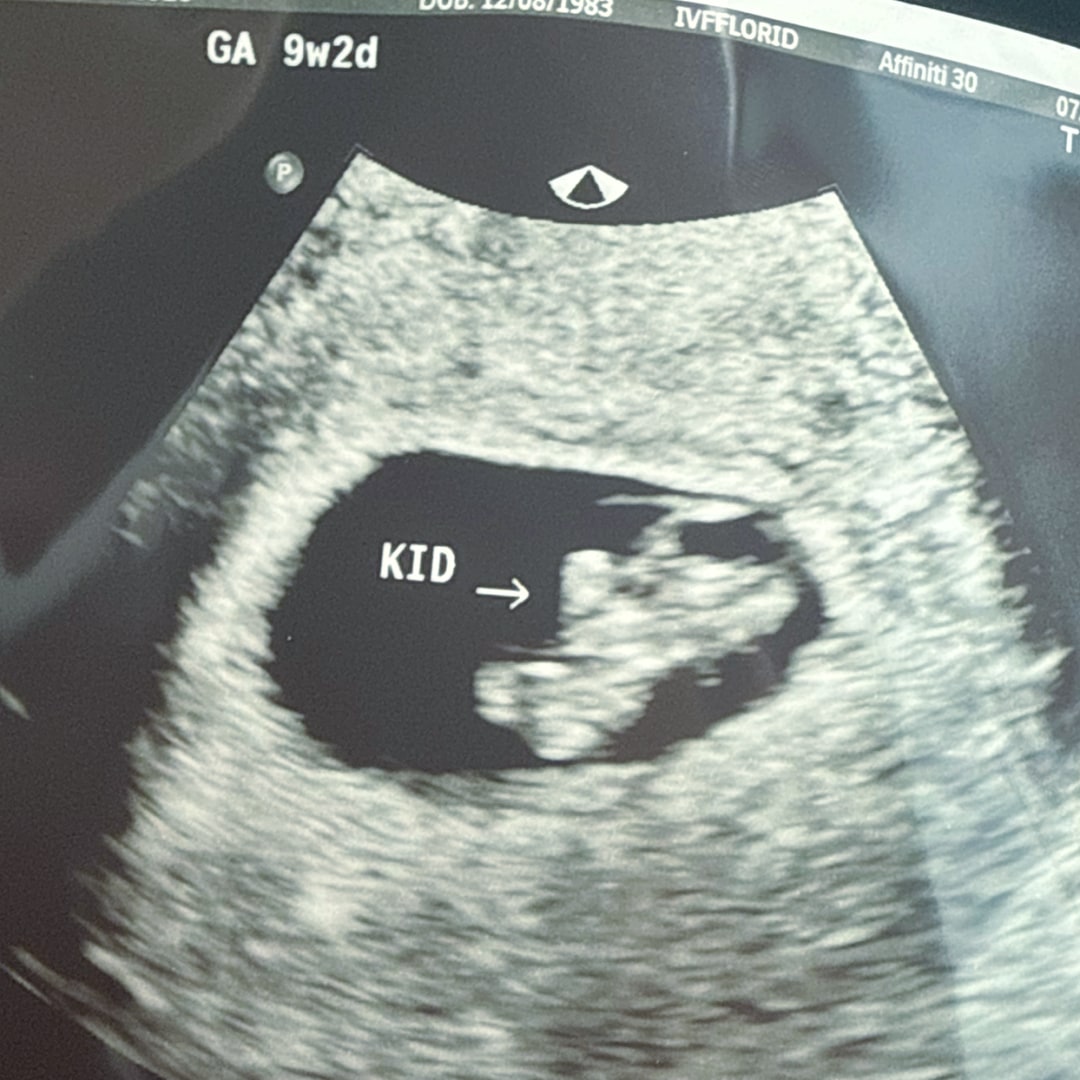 Photo shared by Shaneva for their Babylist baby registry.
