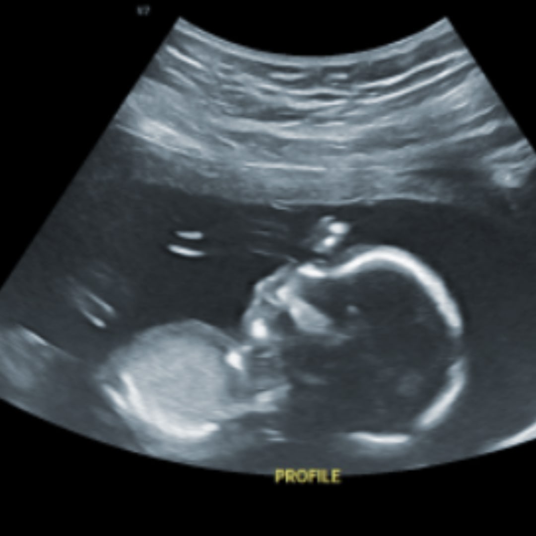 Photo shared by Jasmine for their Babylist baby registry.