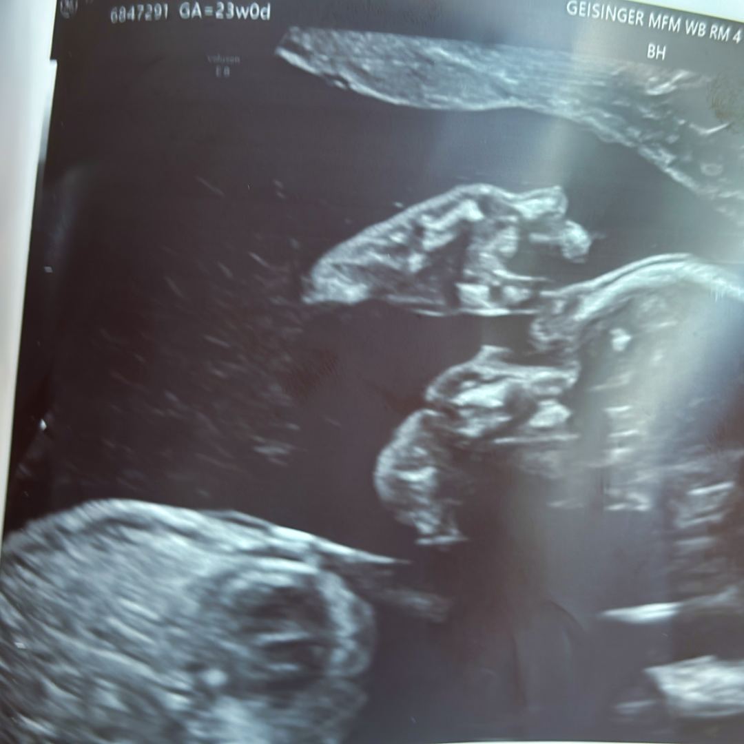 Photo shared by Aliz for their Babylist baby registry.