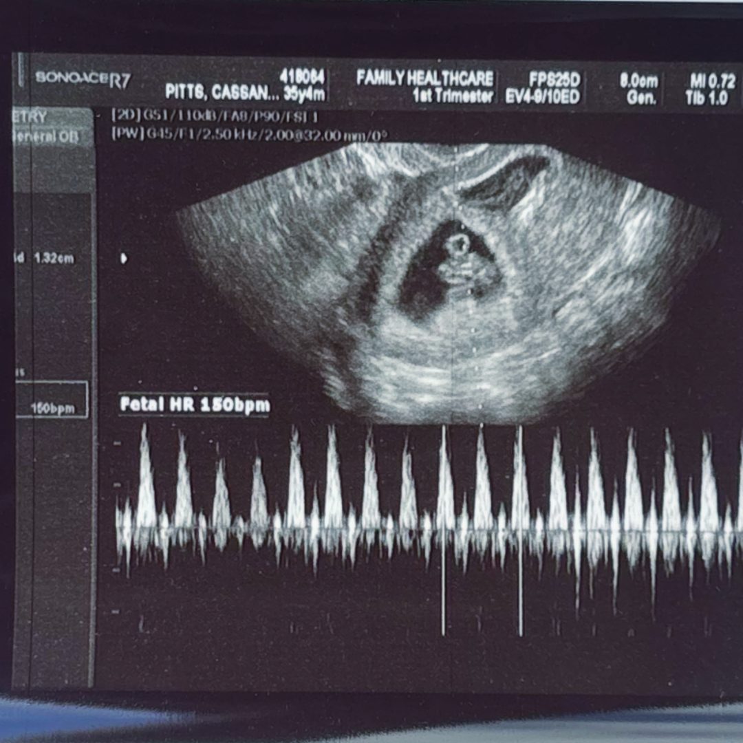 Photo shared by Cassandra for their Babylist baby registry.