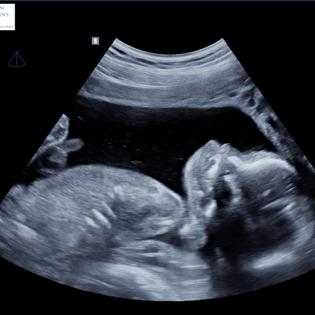 Photo shared by Promise for their Babylist baby registry.