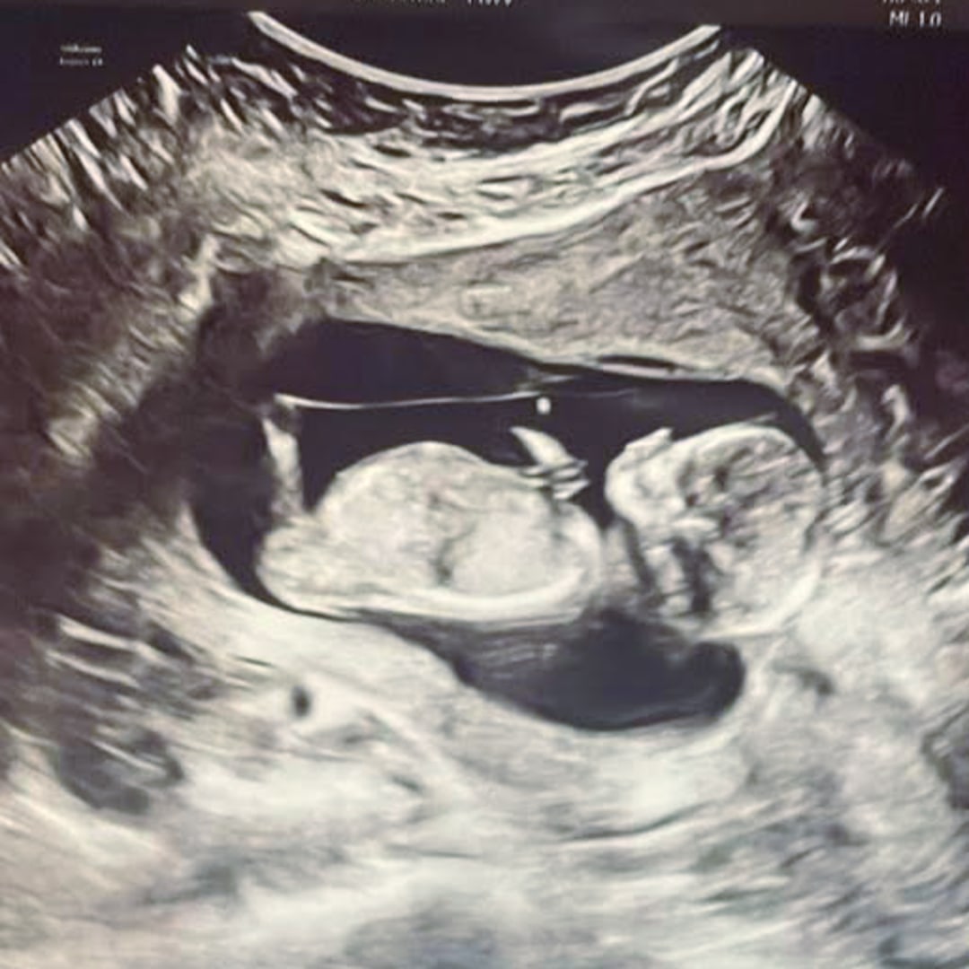 Photo shared by Sarah for their Babylist baby registry.