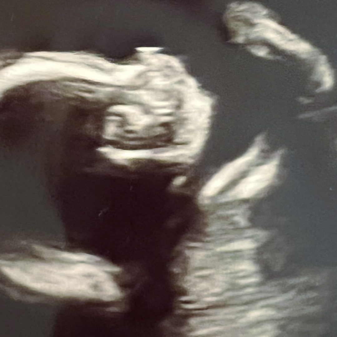 Photo shared by Amanda for their Babylist baby registry.