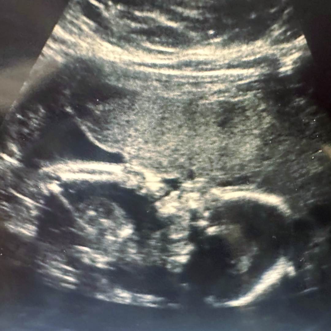 Photo shared by Megan for their Babylist baby registry.