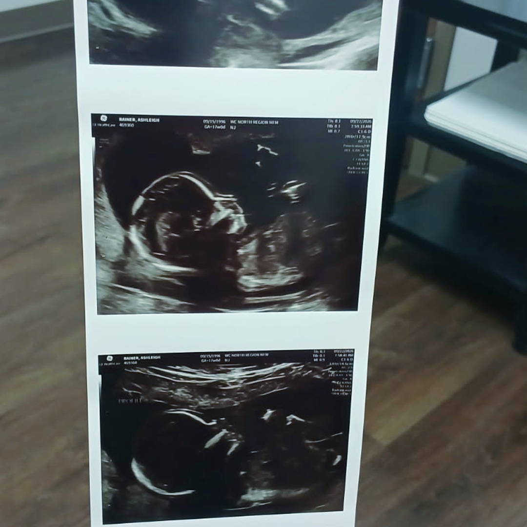 Photo shared by Ashleigh for their Babylist baby registry.