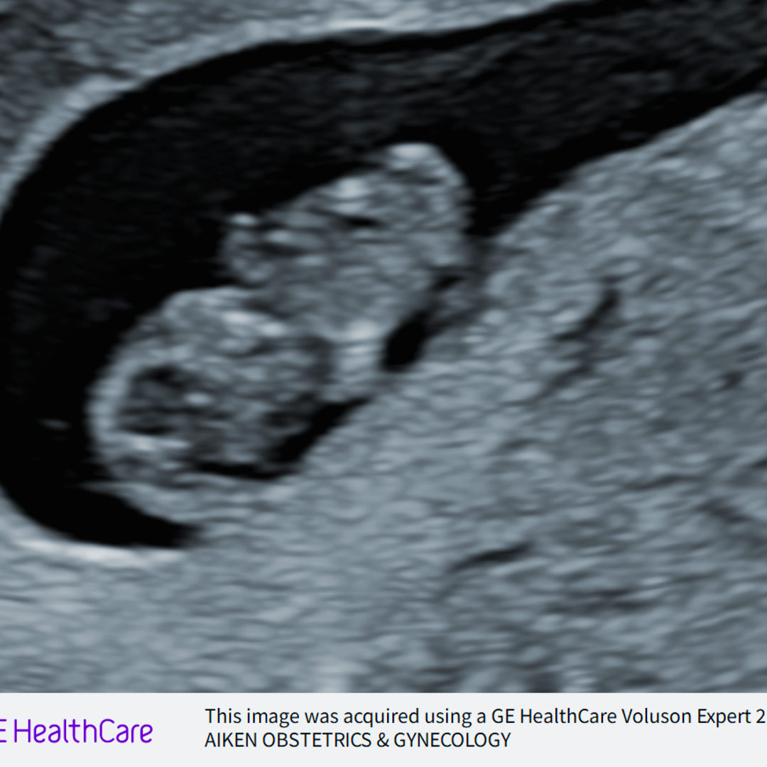 Photo shared by Adrena for their Babylist baby registry.