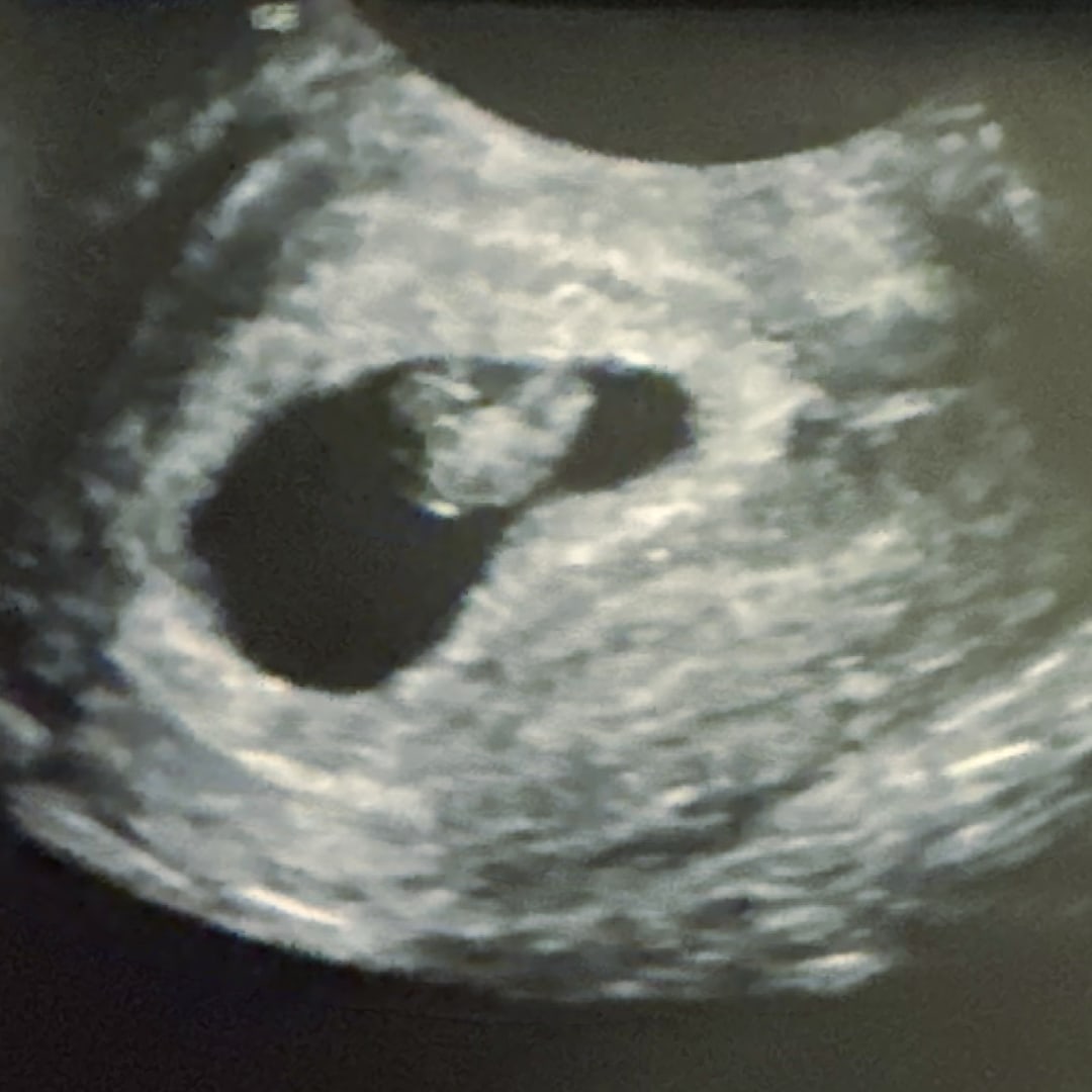 Photo shared by Olivia for their Babylist baby registry.