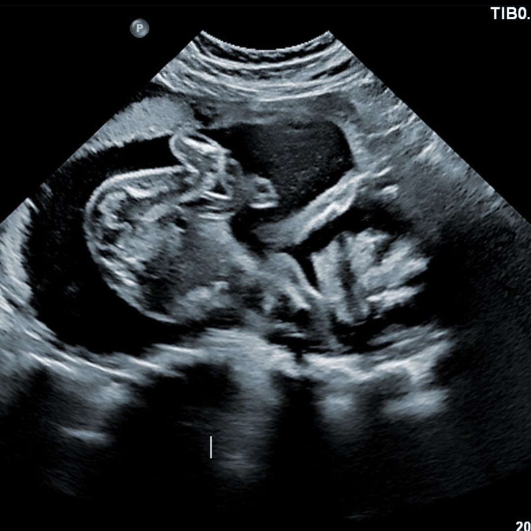 Photo shared by Cylie for their Babylist baby registry.