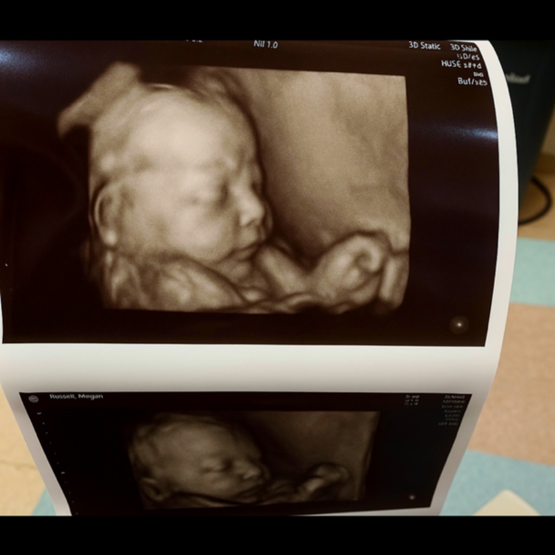 Photo shared by Megan for their Babylist baby registry.