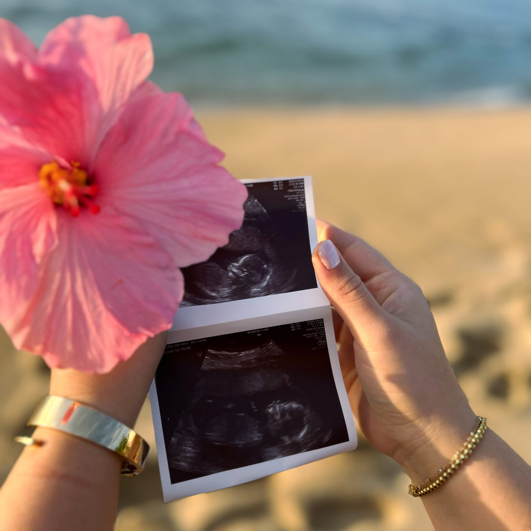 Photo shared by Brittney for their Babylist baby registry.