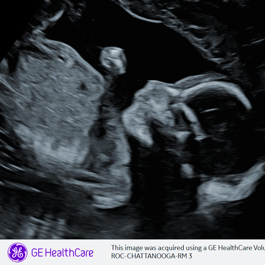 Photo shared by Carly for their Babylist baby registry.