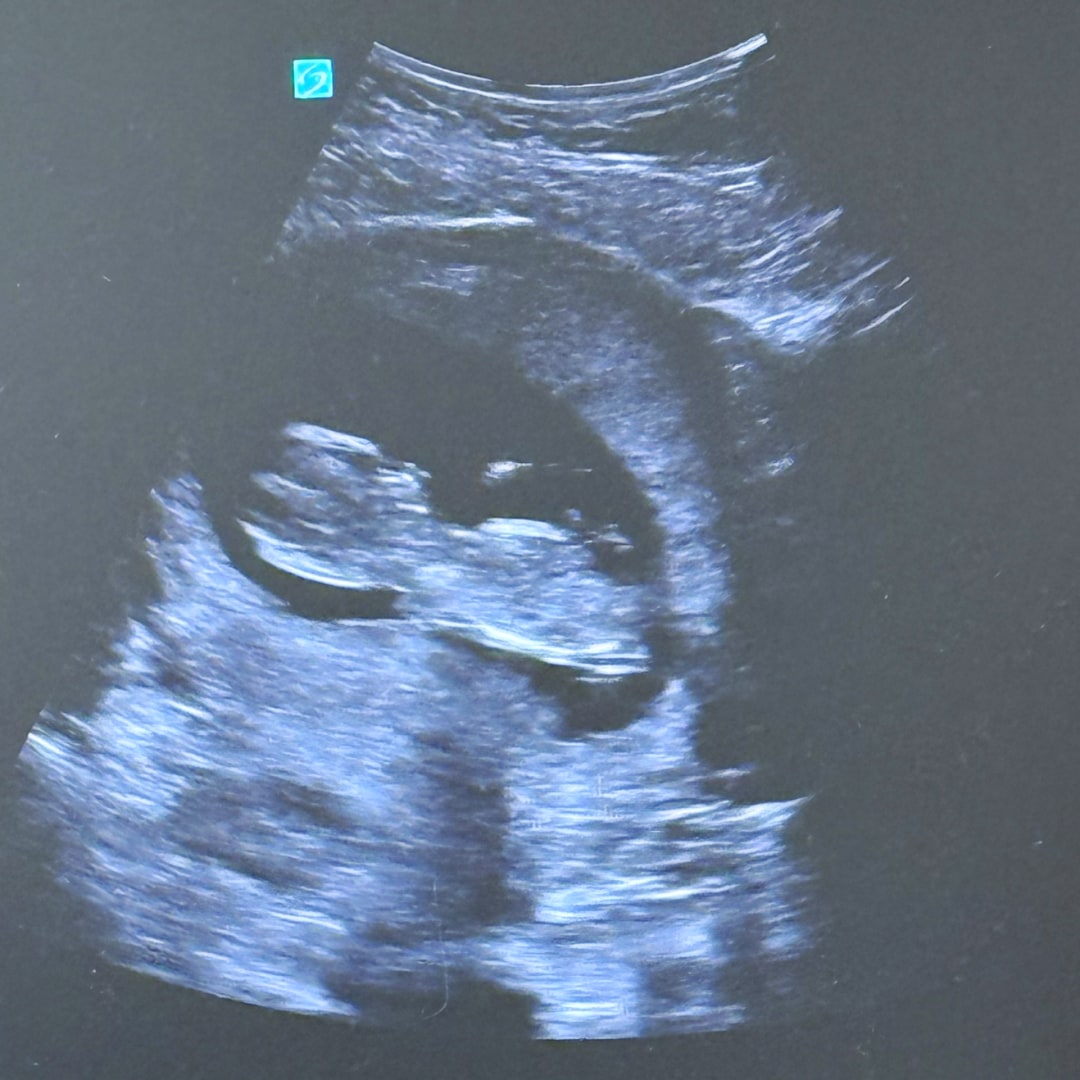 Photo shared by Payge for their Babylist baby registry.