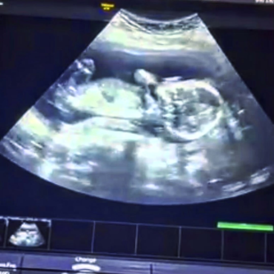 Photo shared by Damien for their Babylist baby registry.