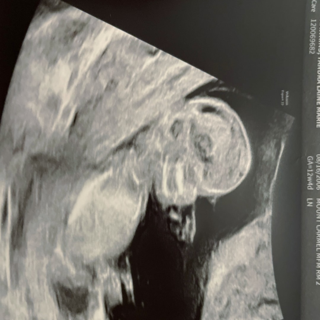Photo shared by Tandra for their Babylist baby registry.