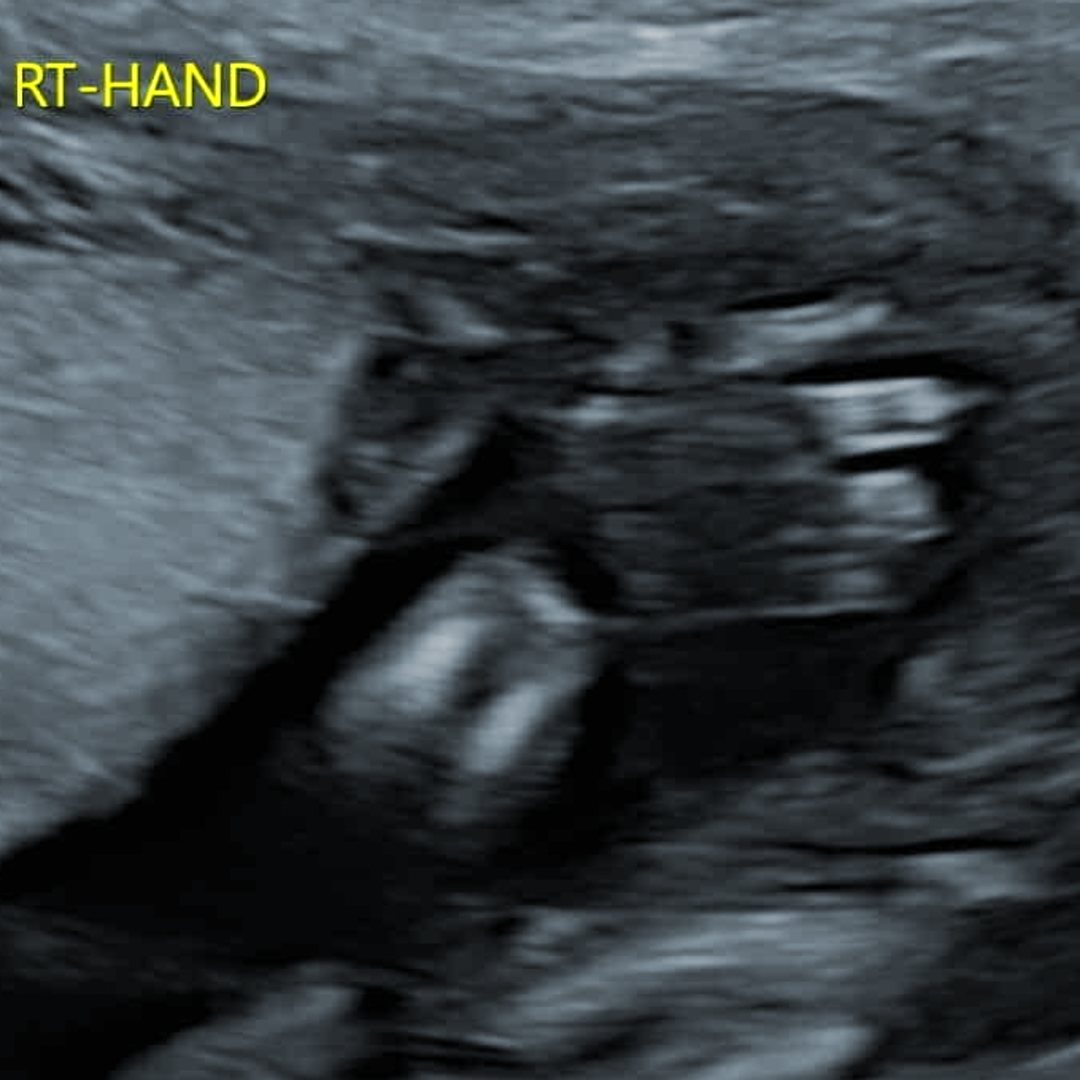 Photo shared by Skye for their Babylist baby registry.