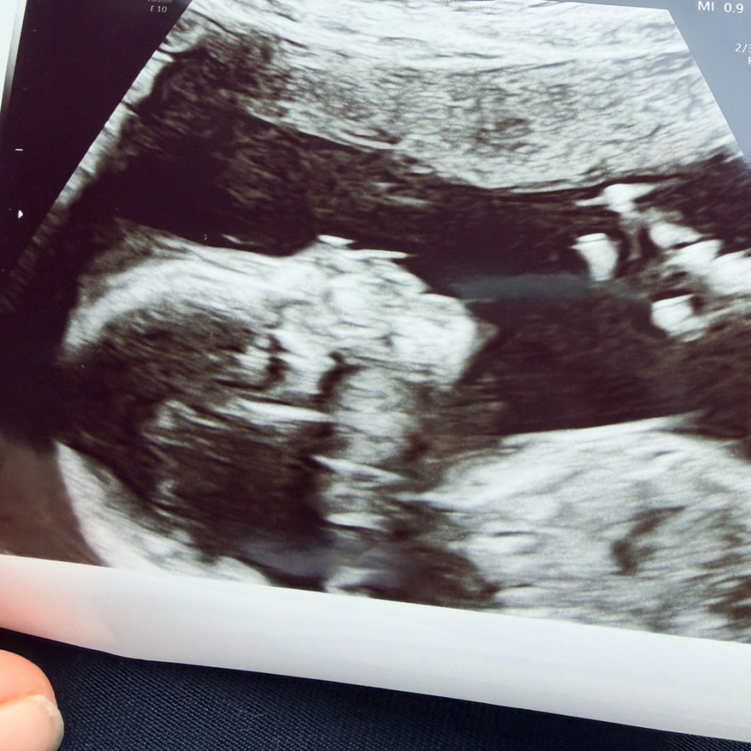 Photo shared by April for their Babylist baby registry.